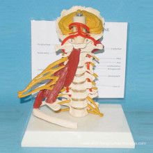 Human Natural Cervical Spine Model with Muscle and Nerve